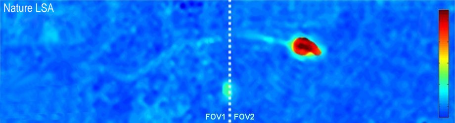 Double_FOV Double_FOV